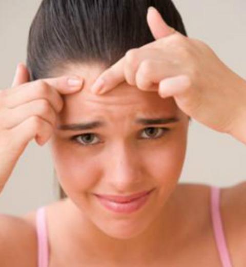 guide to Get rid of Acne